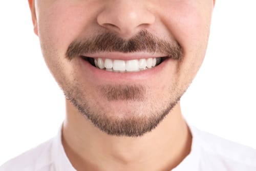 Close up of a man smiling with straight white teeth
