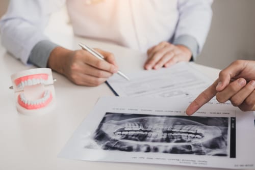 Dentist pointing at a dental x-ray