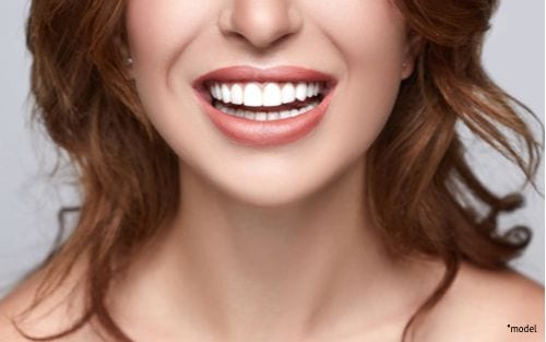 A woman smiles after having dental work done, feeling confident enough to show her teeth off. 