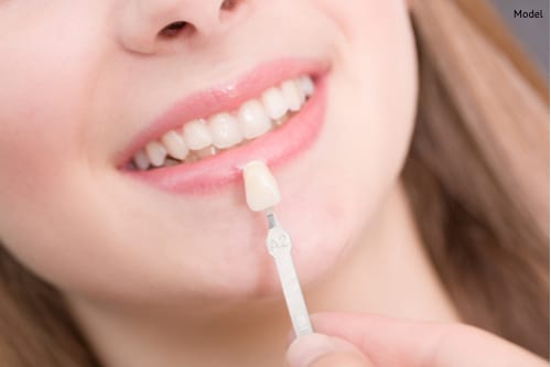 Porcelain veneers are matched to a young woman's teeth, ensuring a natural finish.