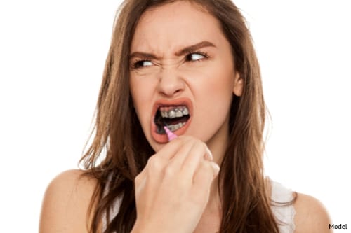 Charcoal toothpaste may not accomplish all that it promises for teeth whitening img blog