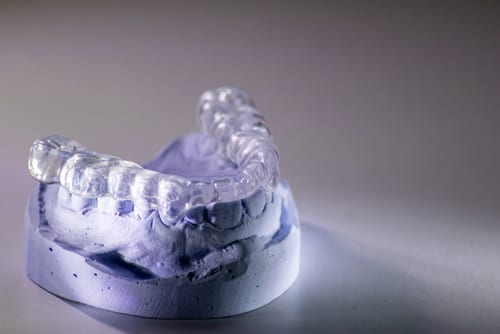 A mold of a patient's teeth with a mouthguard